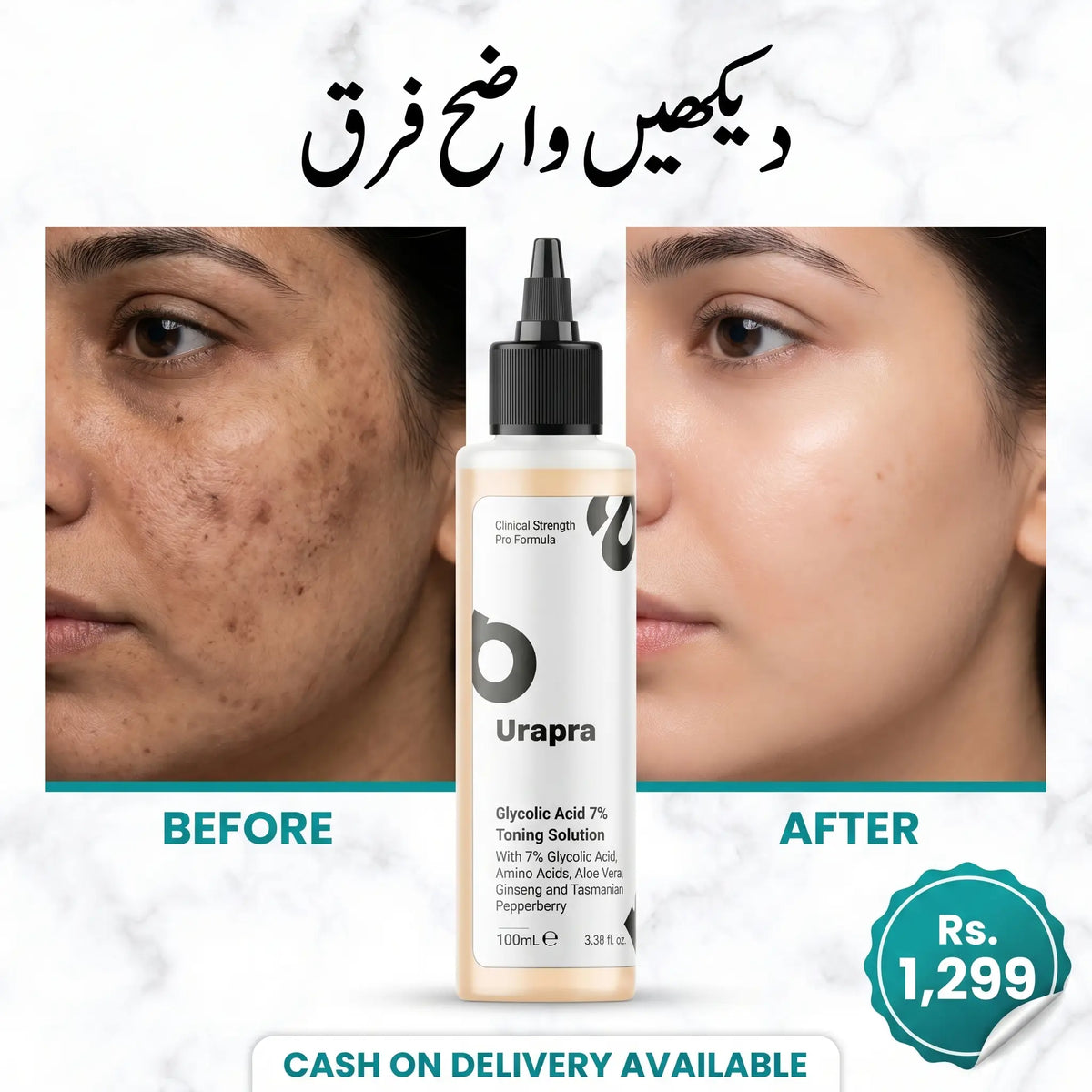 Urapra Glycolic Acid